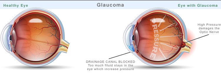 eye doctor eye examination